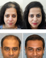 Adivasi Renuka Hair Growth Oil